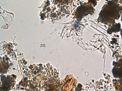 phyto/Scattered_Islands/europa/COMMA April 2011/Heteroleibleinia sp (2)(copy)_thumb.jpg